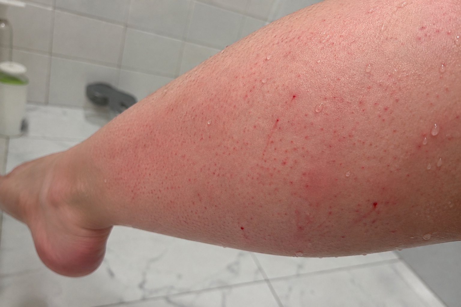 A woman's shin just after shaving, with visible red dots and water droplets